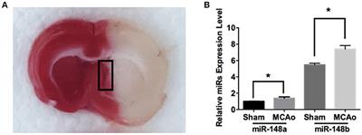 miR-148b Regulates Proliferation and Differentiation of Neural Stem Cells via Wnt/β-Catenin Signaling in Rat Ischemic Stroke Model